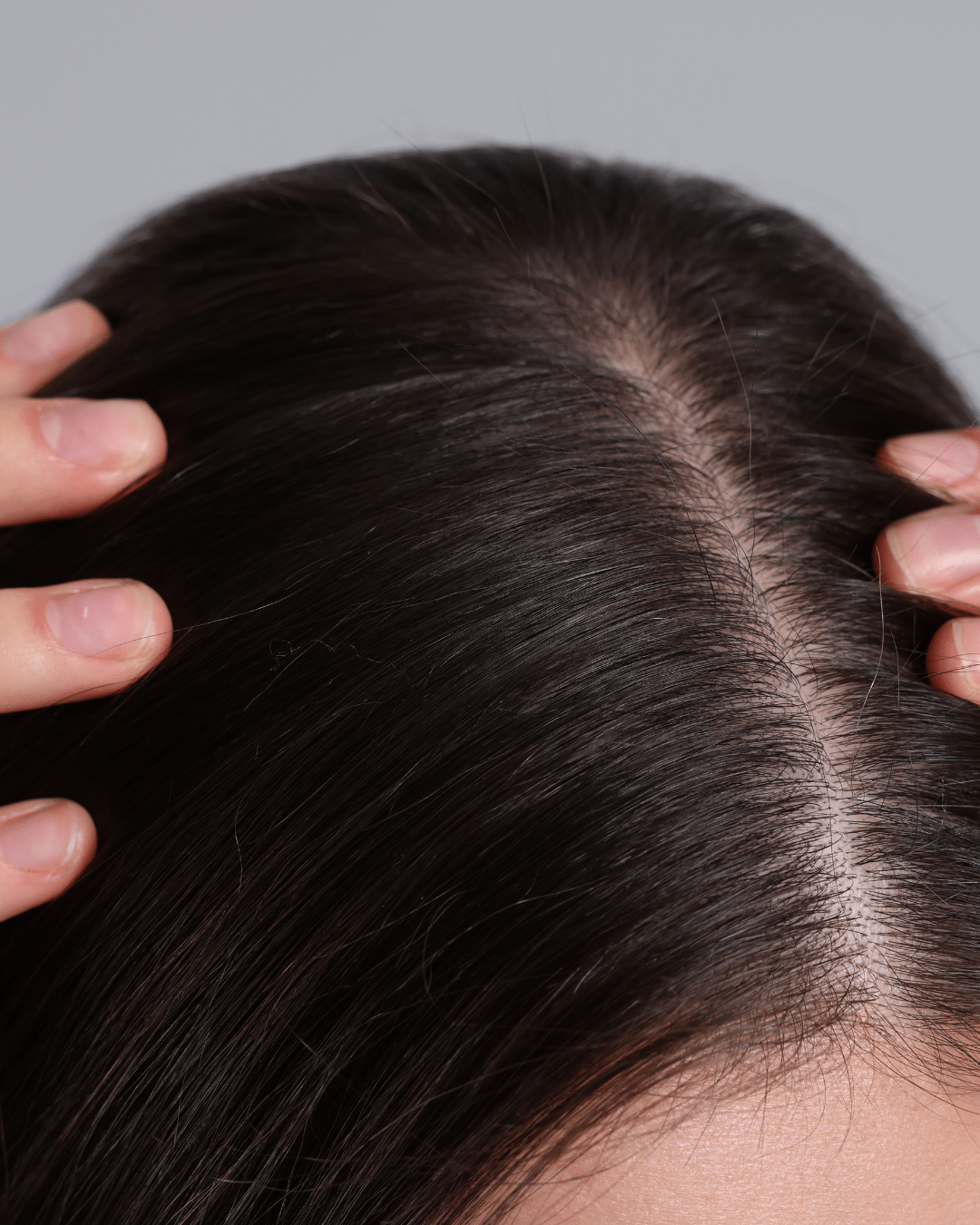 Hydra Mist - Scalp Hydration Mist With Hyaluronic Acid & Postbiotic Ferments - Haira Lab.